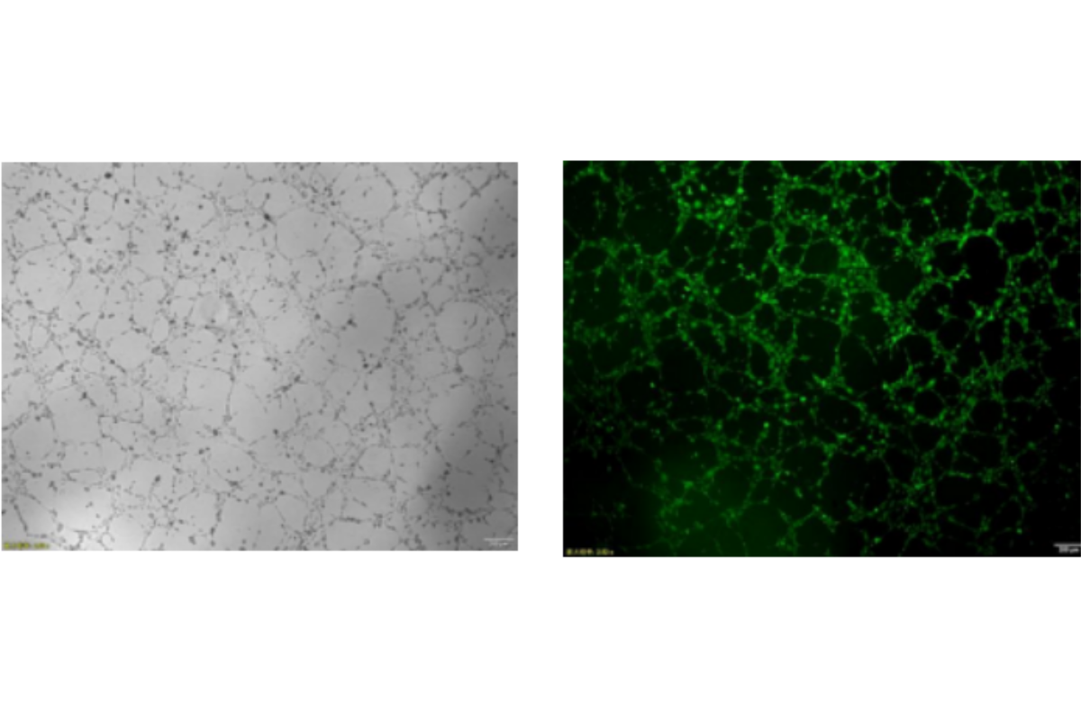 Angiogenesis Assay Case Study 4