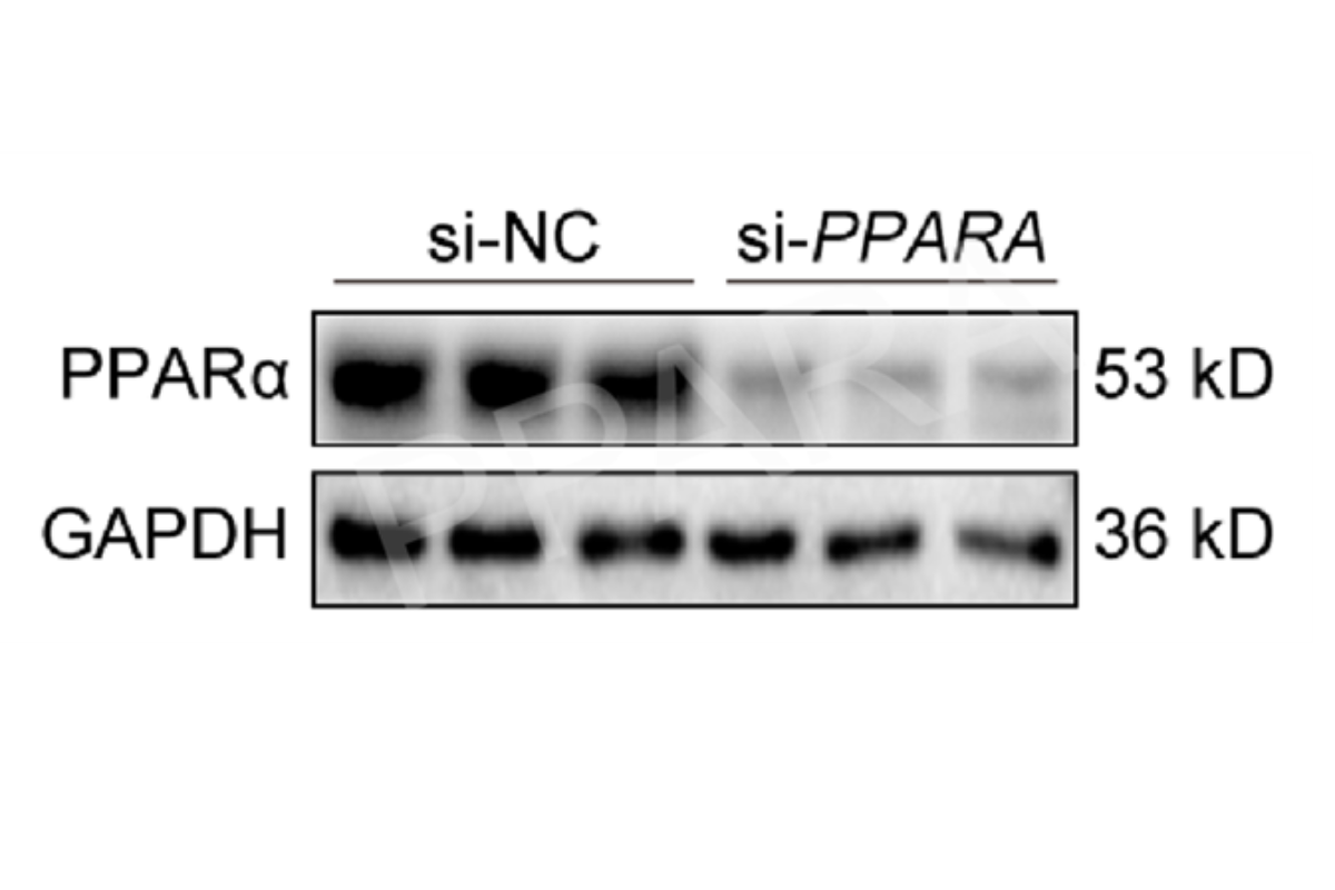 Cell Transfection | LX-2 (Human hepatic stellate cell) Cells Transfection – siRNA