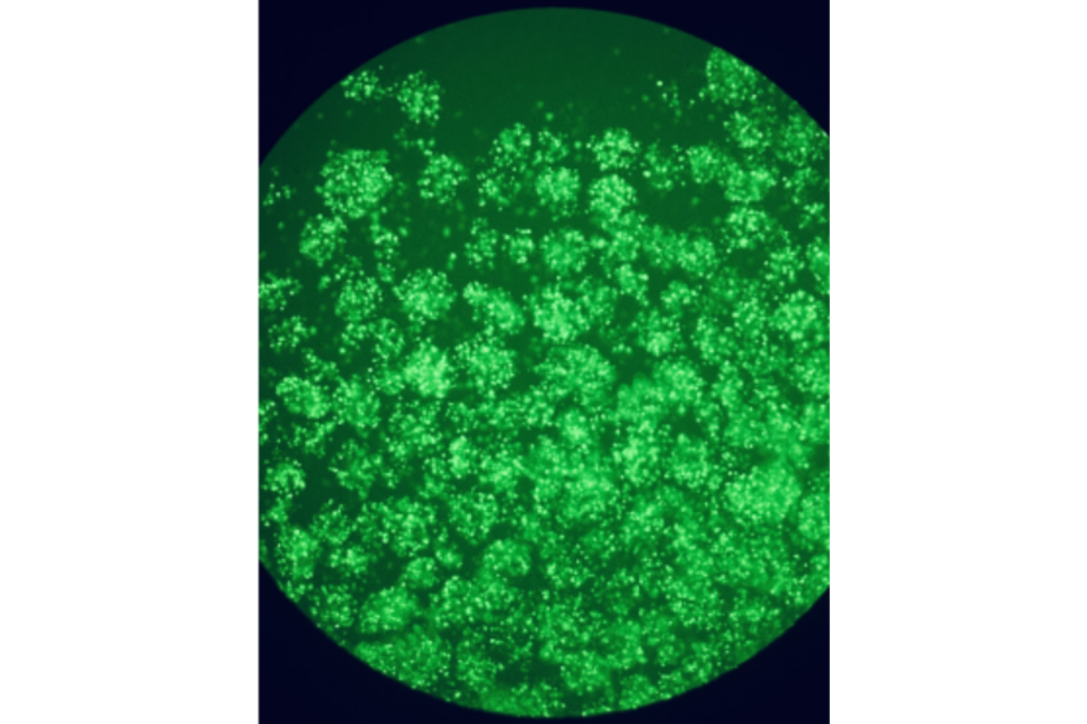 Cell Transfection | Jurkat (Human T-Lymphocyte Leukemia Cells) Cells Transfection – mRNA