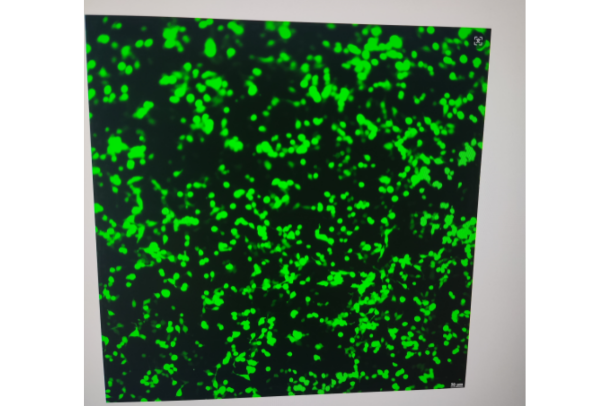 Cell Transfection | Transfection of 786-O (Human Renal Clear Cell Adenocarcinoma Cells)-DNA