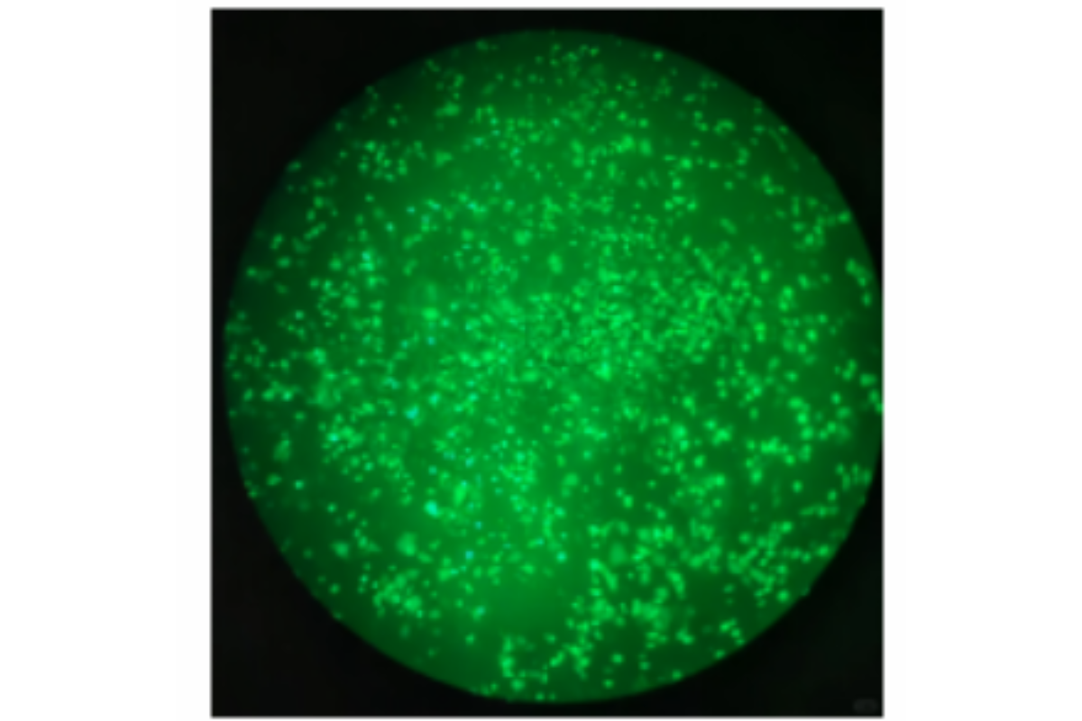 Cell Transfection | Transfection of 293A Human Embryonic Kidney Cells-DNA (30K Adenovirus Packaging)
