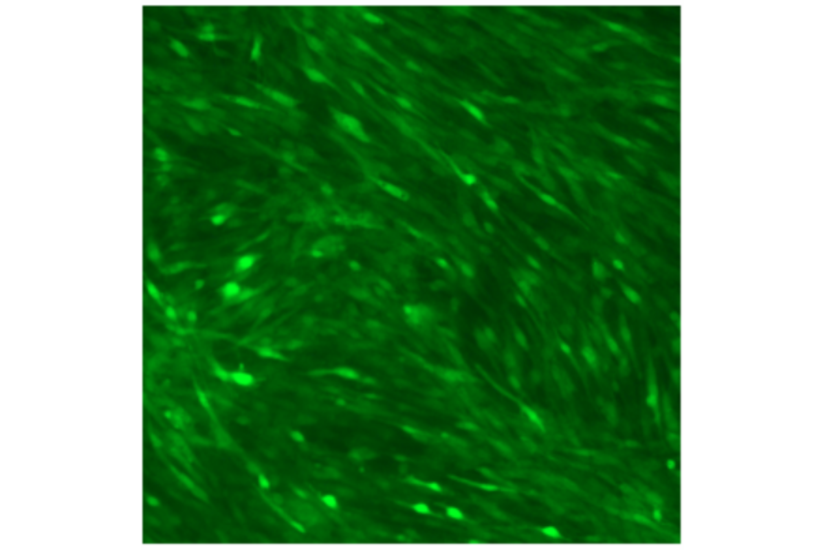 Cell Transfection | Transfection of HL-1 mouse cardiomyocytes -DNA