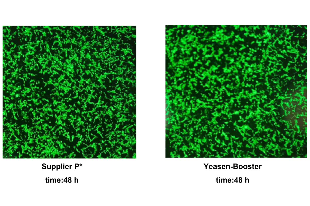 Cell Transfection | Transfection of C4-2 (Human Prostate Cancer Cells )-DNA