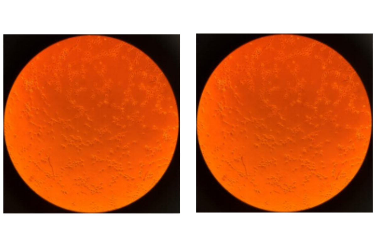 Angiogenesis Assay Case Study 6