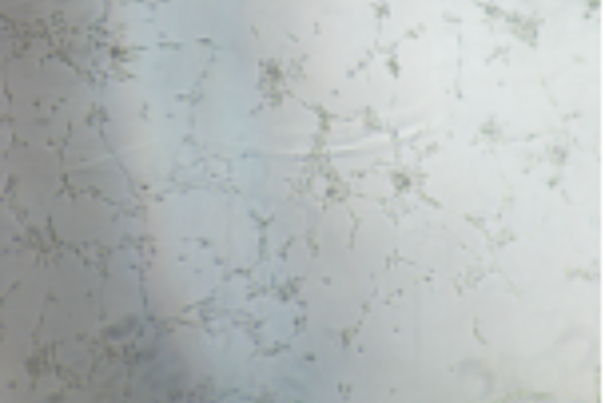Angiogenesis Assay Case Study 7
