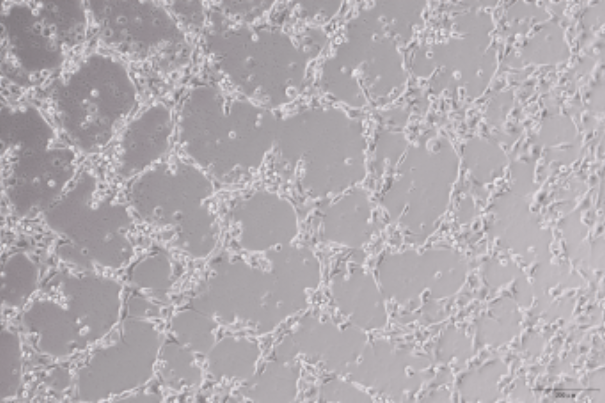 Angiogenesis Assay Case Study 8