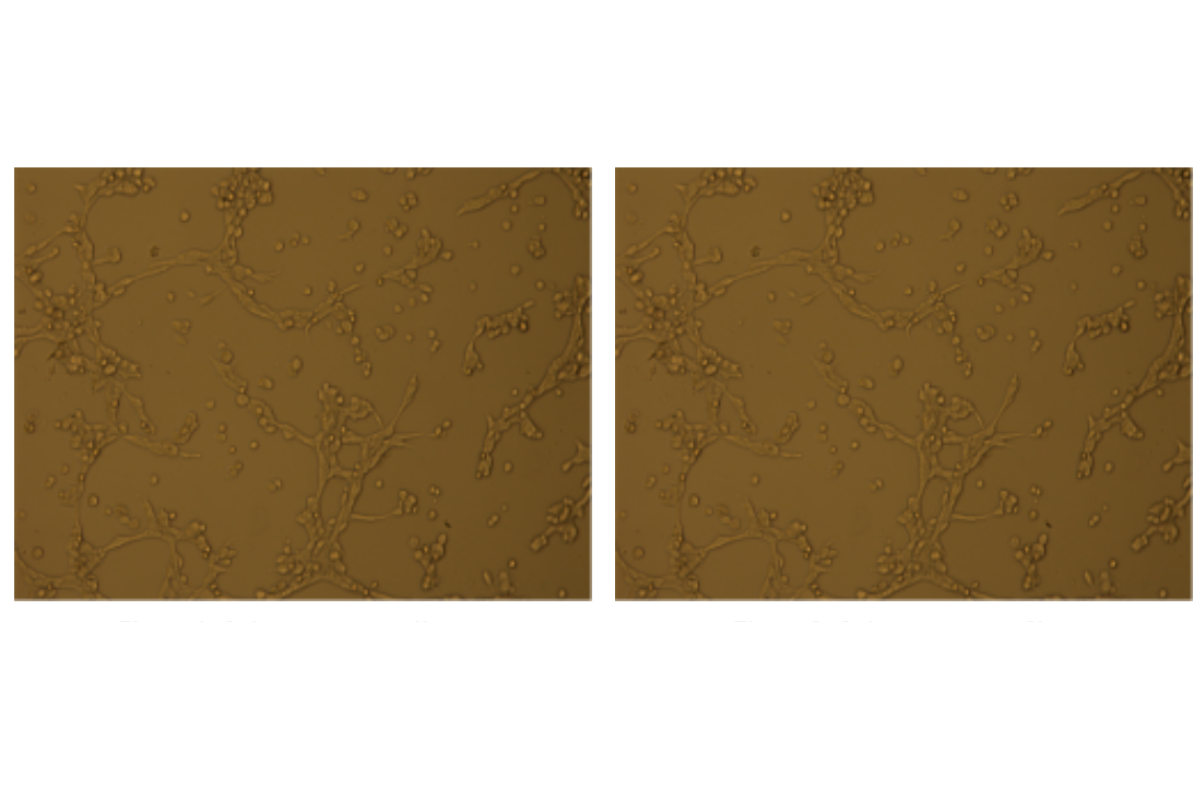 Angiogenesis Assay Case Study 9