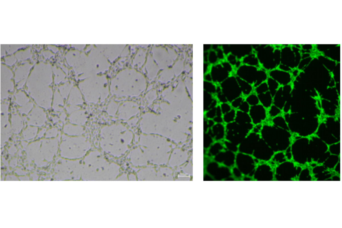 Angiogenesis Assay Case Study 10