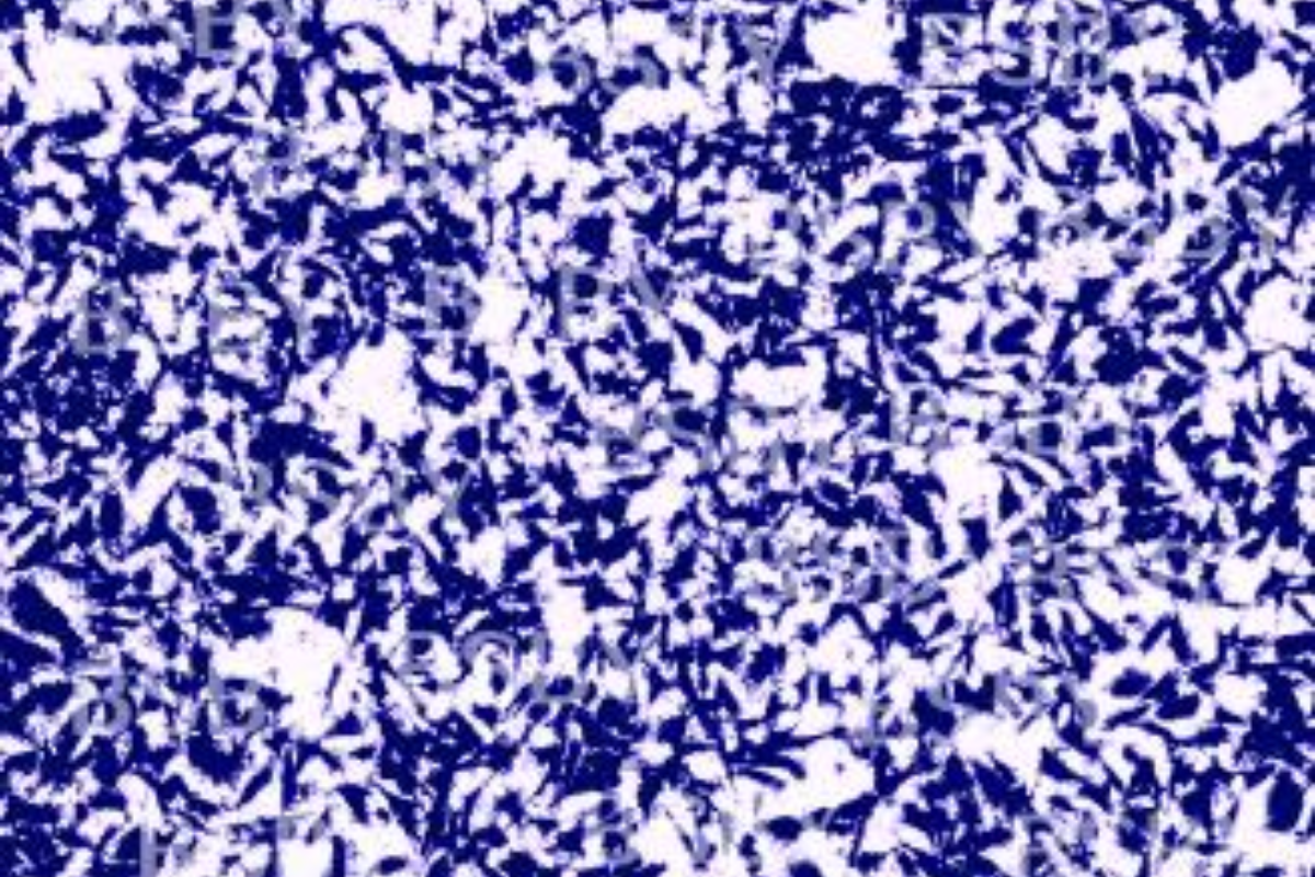 Cell Invasion Assay: Breast Cancer (MDA-MB-231) Cell Invasion Model