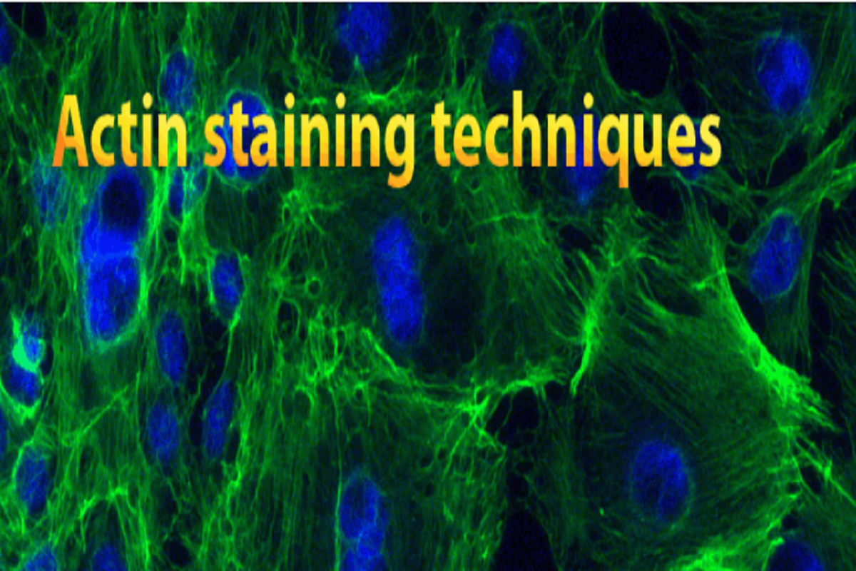 A Comprehensive Guide to Phalloidin Staining for Cytoskeleton