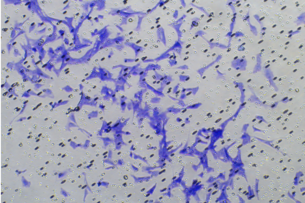Cell Invasion Assay: Rat Osteosarcoma (UMR-106) Cell Invasion Model