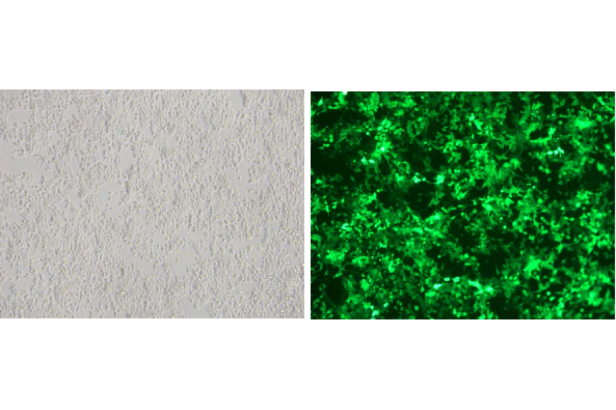 Large-Scale Plasmid Preparation Case Study: High-Yield Plvx-PGK Plasmid from 80 mL Bacterial Culture