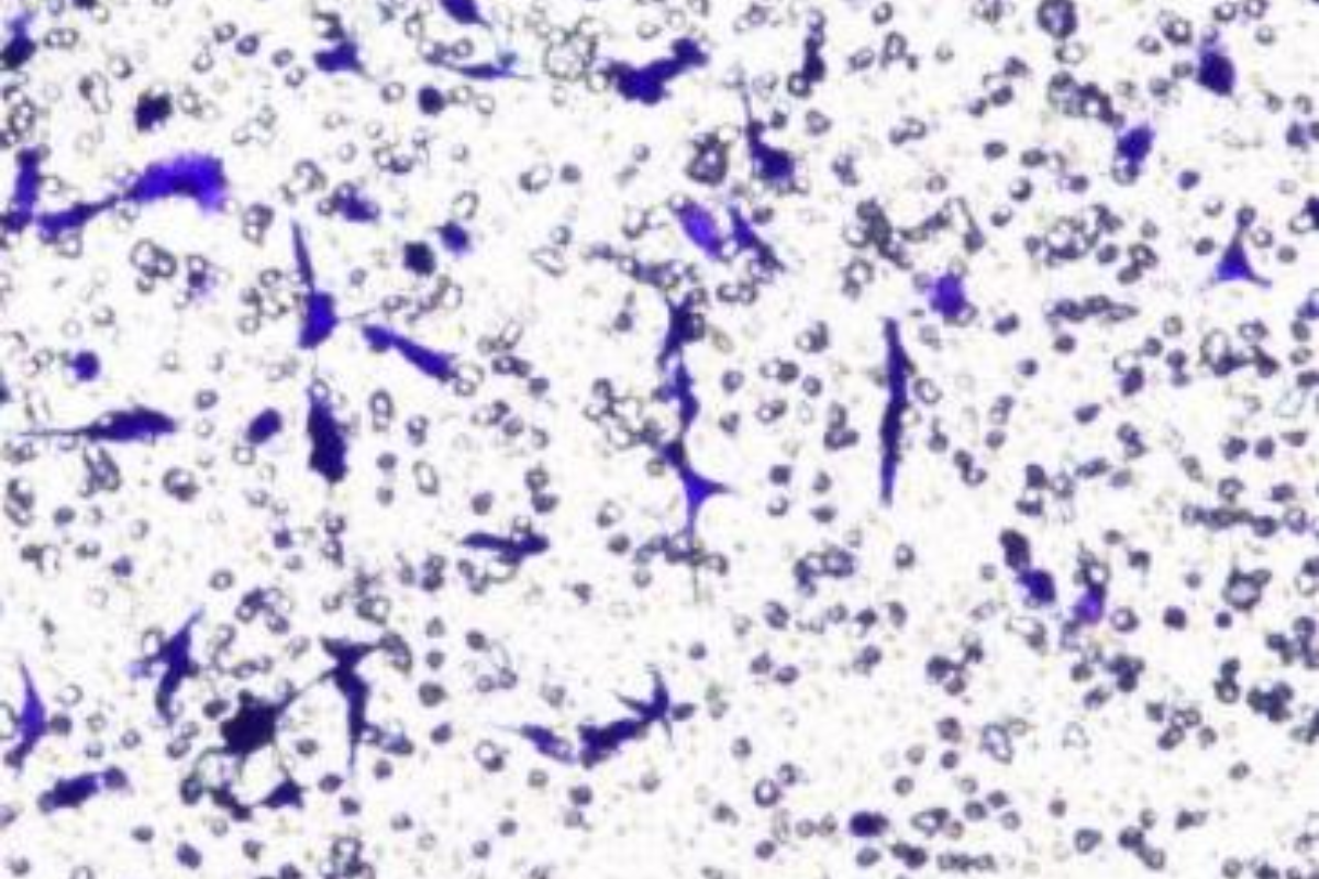 Cell Invasion Assay: Human Glioblastoma (U-87) Cell Invasion Model