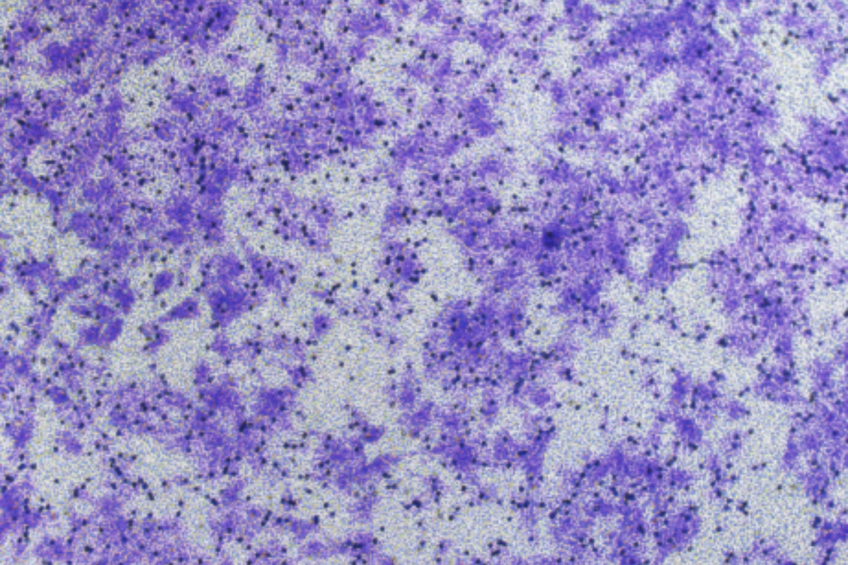 Cell Invasion Assay: Colorectal Cancer (HCT116) Cell Invasion Model
