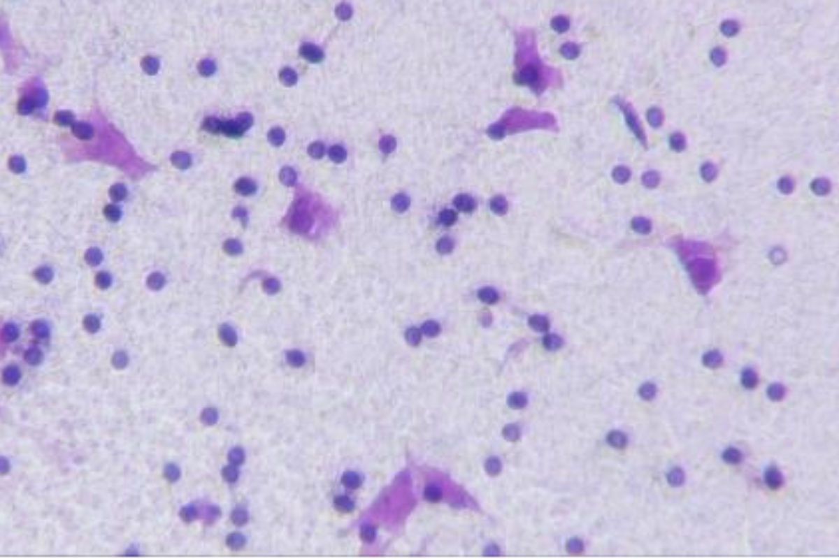 Cell Invasion Assay: Melanoma (B16F10) Cell Invasion Model