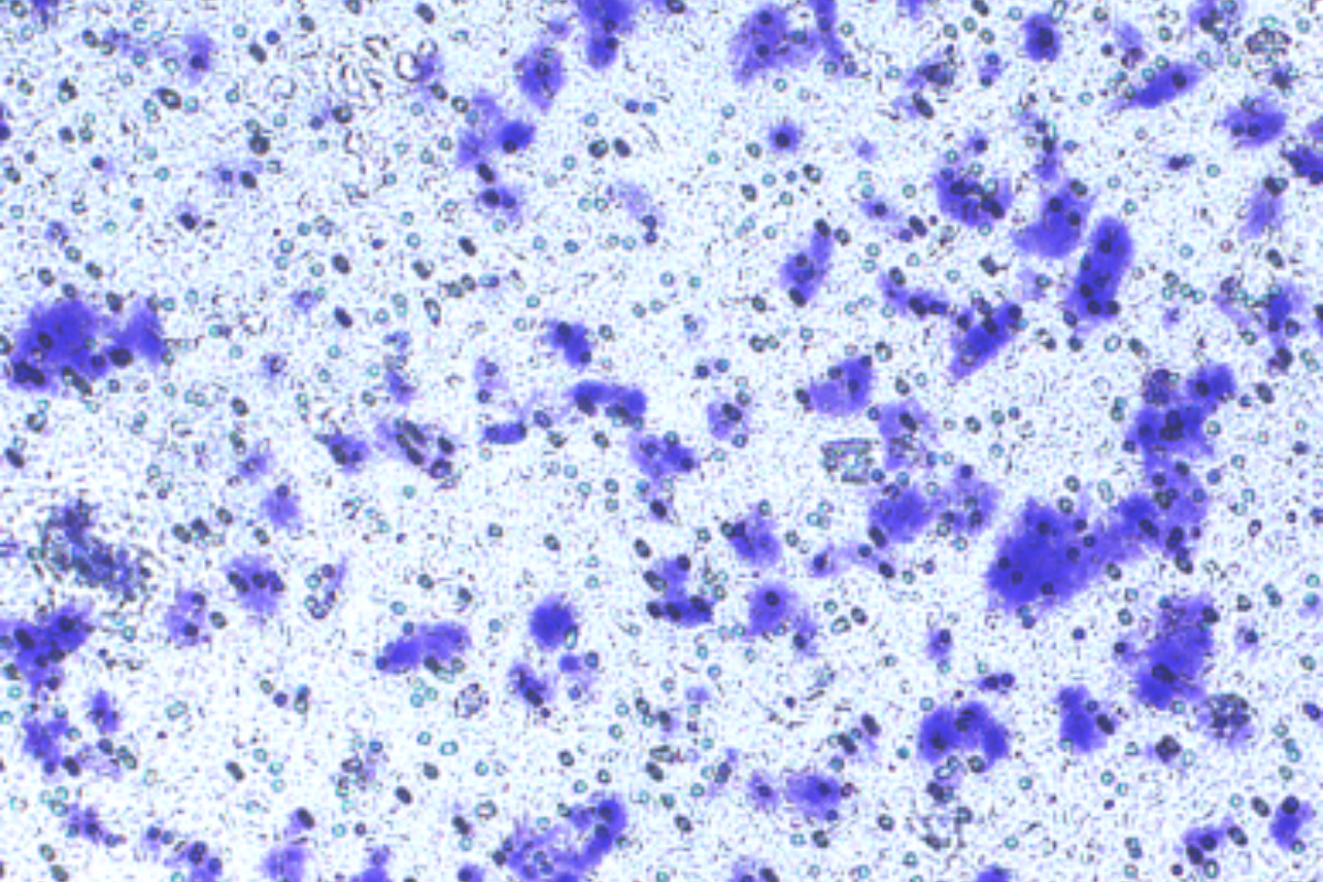 Cell Invasion Assay: Lung Cancer (PC-9) Cell Invasion Model