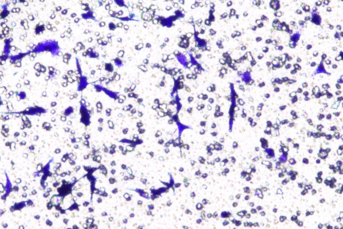 Cell Invasion Assay: Human Glioblastoma (U-251) Cell Invasion Model