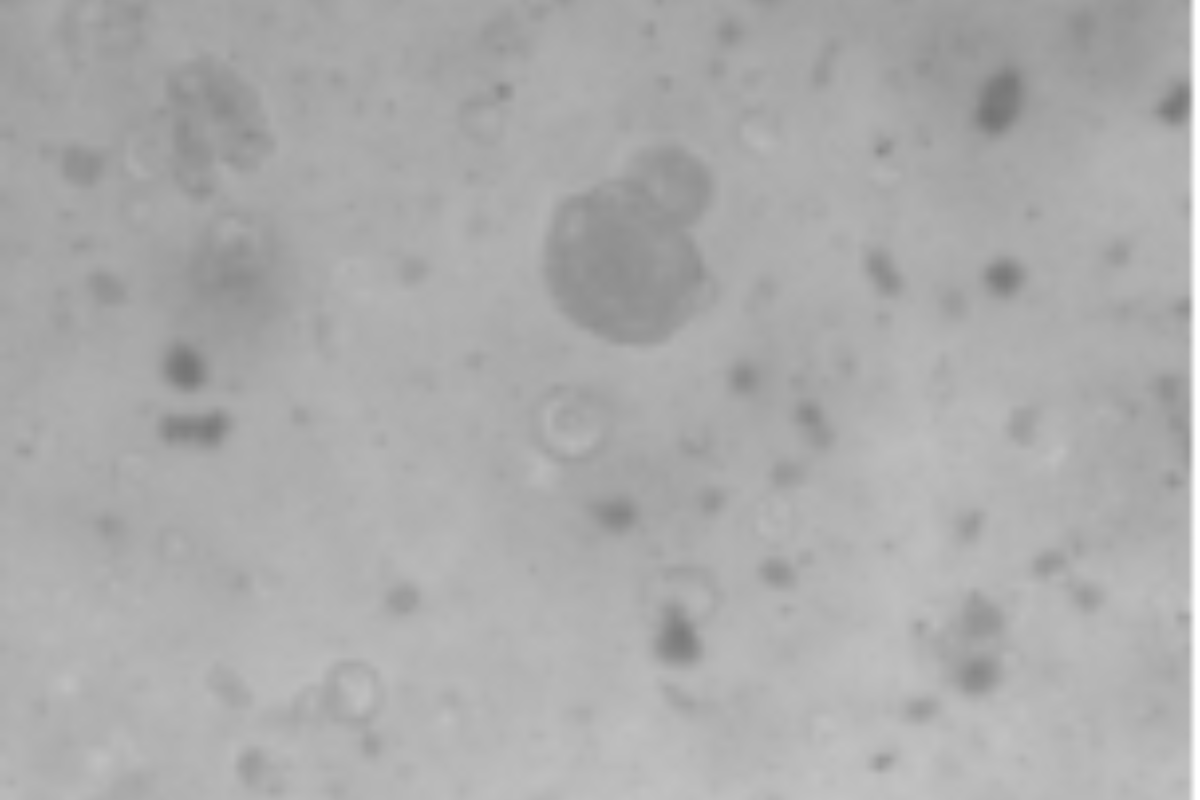 Organoid Construction | Ovarian Cancer Organoid Culture Case Study