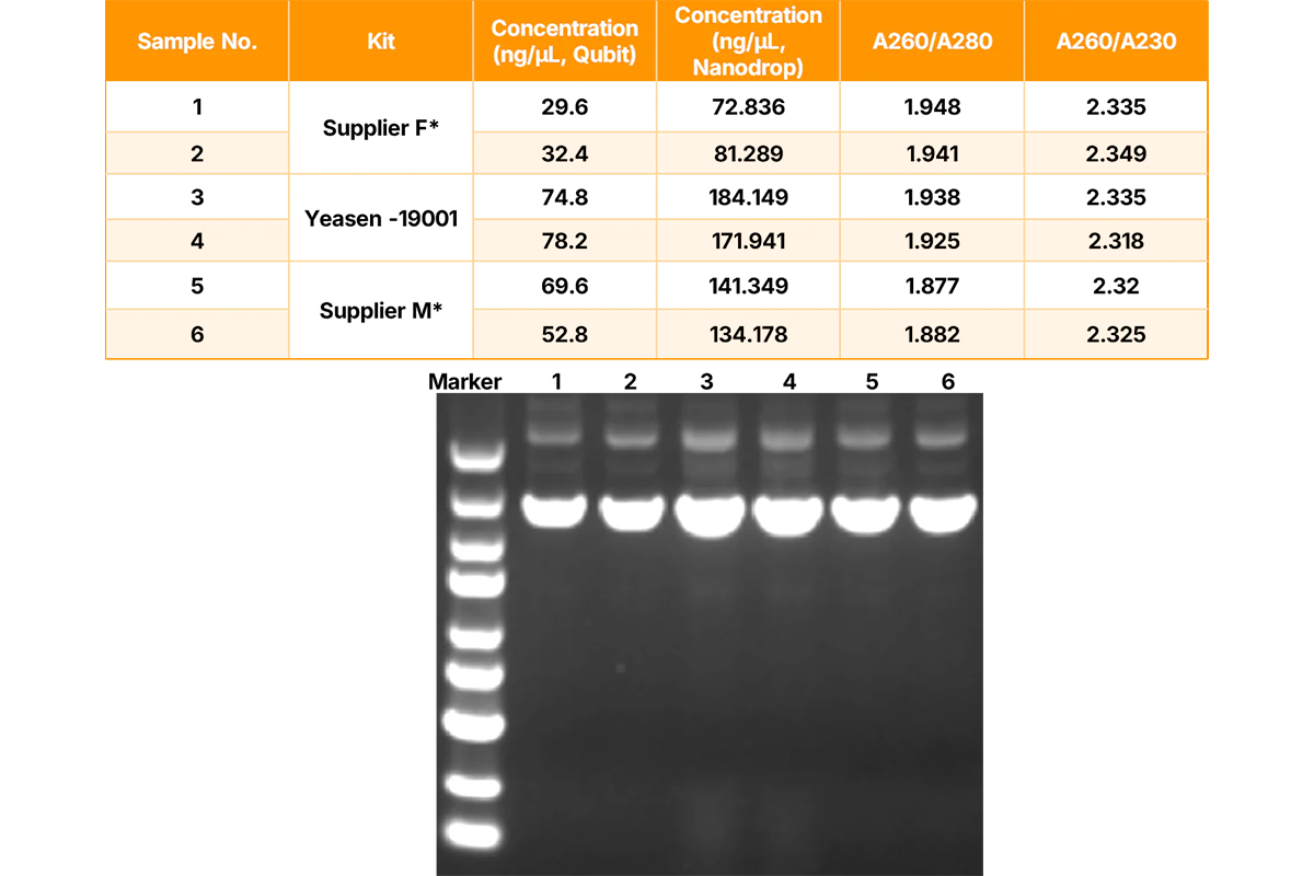 Principles and Troubleshooting of Plasmid Extraction