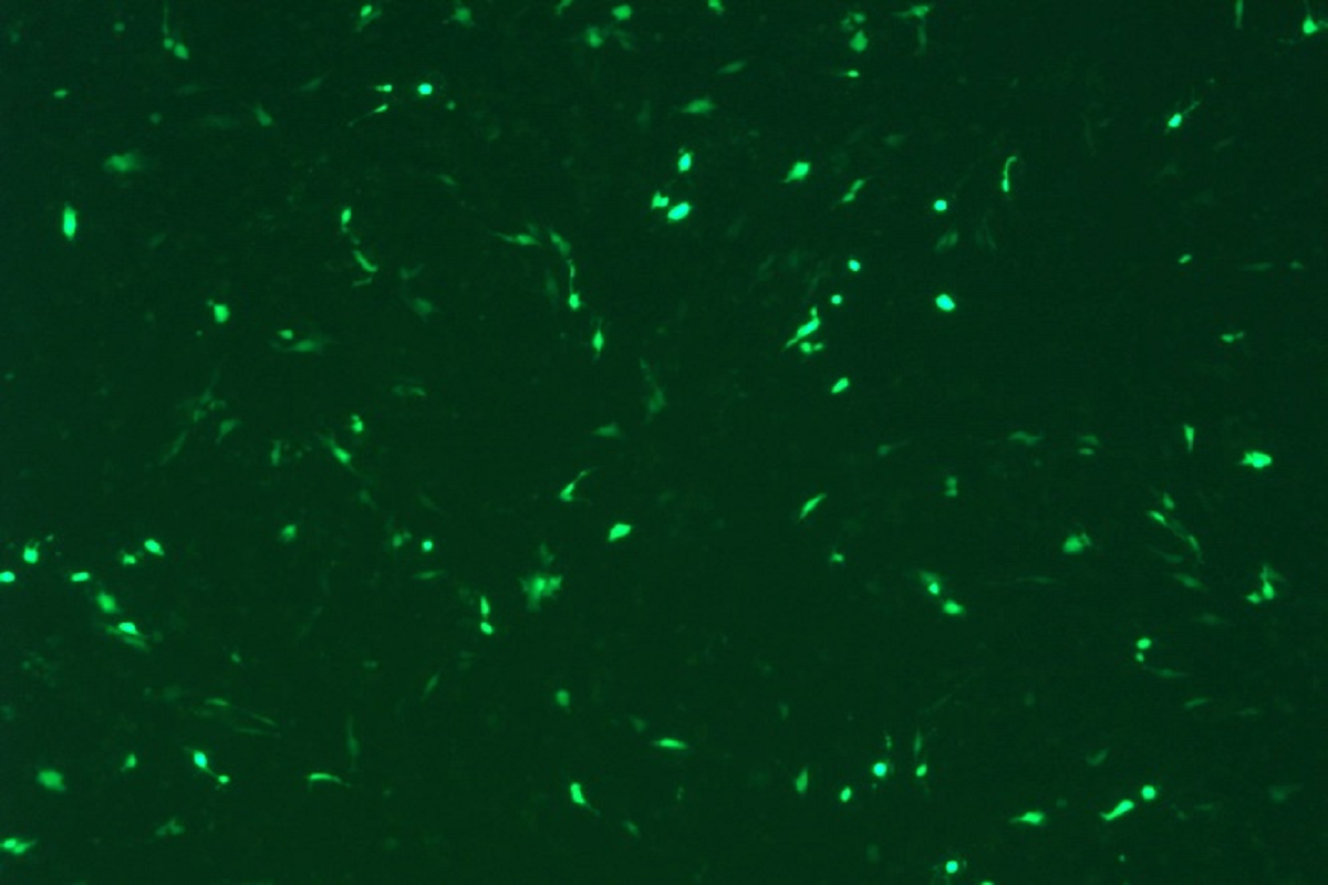 Cell Transfection | AC16 Human Myocardial Cells Transfection – DNA