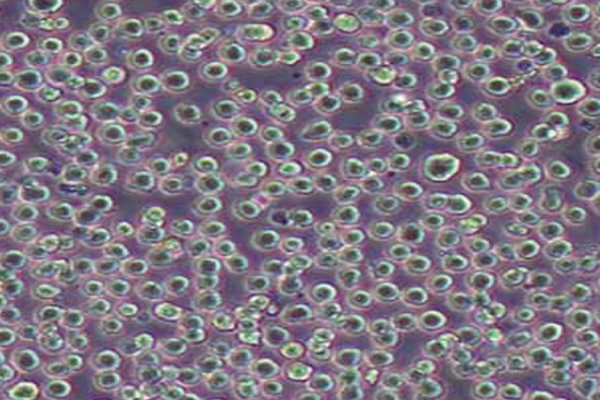 Troubleshooting THP-1 Cell Adhesion During Culture
