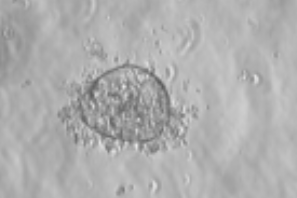 Organoid Construction | Mouse Small Intestine Organoid Culture Case