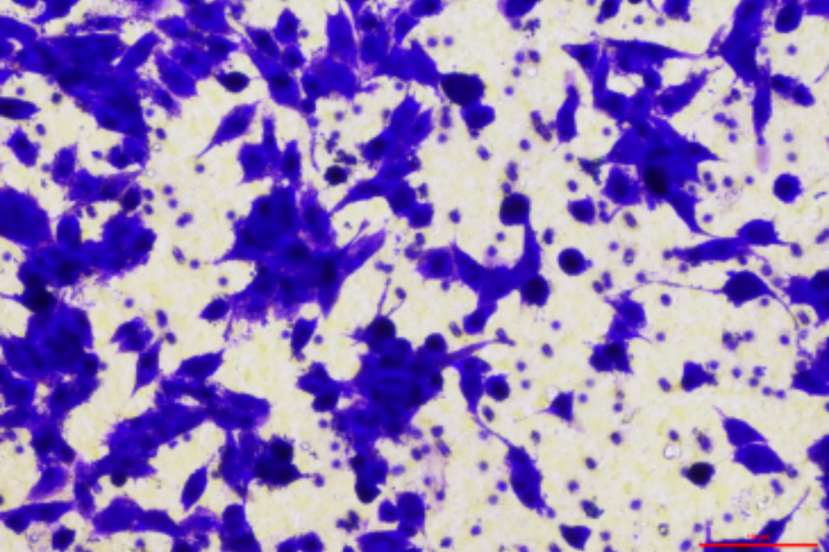 Cell Invasion Assay: Human Cervical Cancer Epithelial Cells (CaSki) Invasion Model