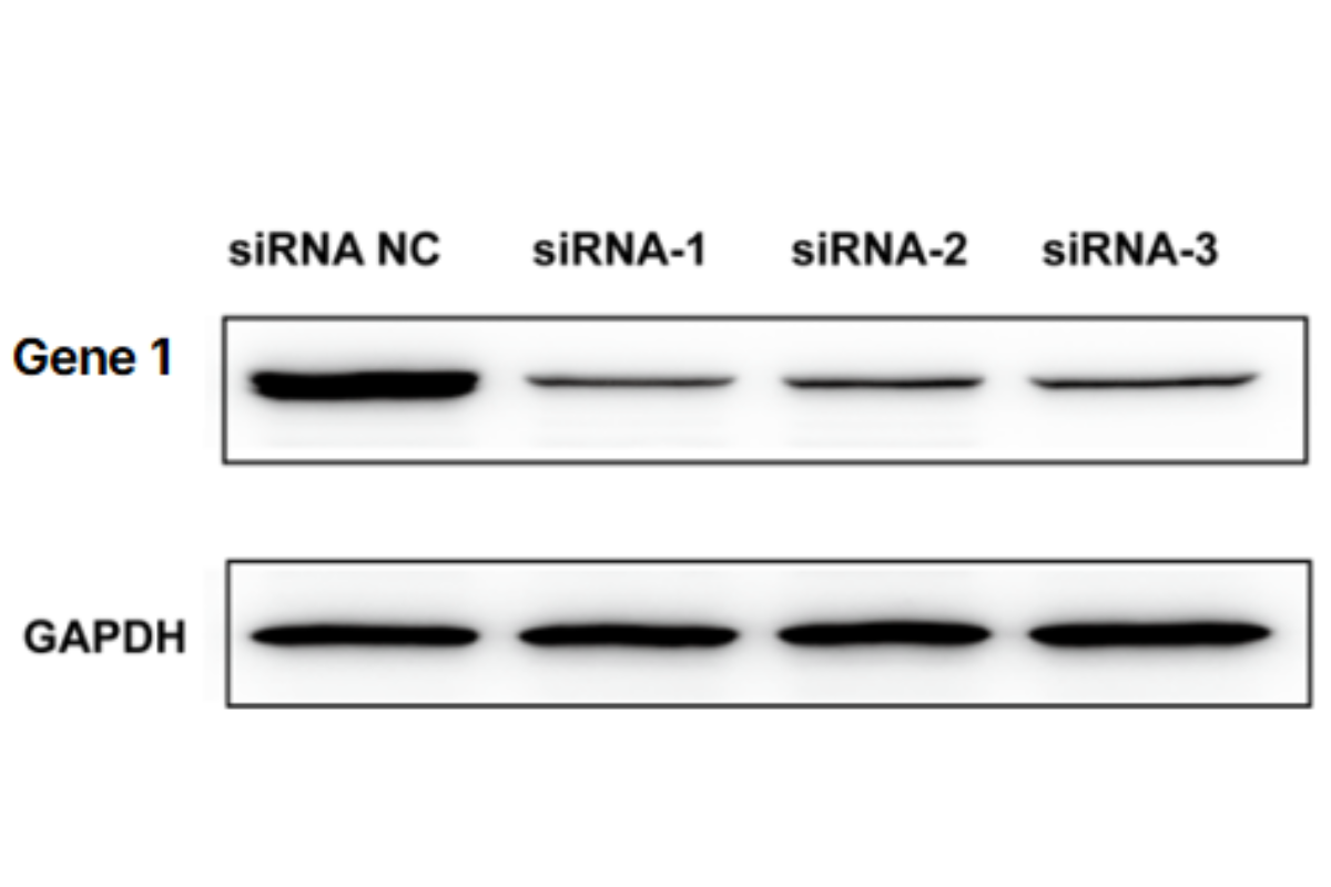 Cell Transfection | THP-1 (Human monocytic leukemia cell) Cells Transfection – siRNA