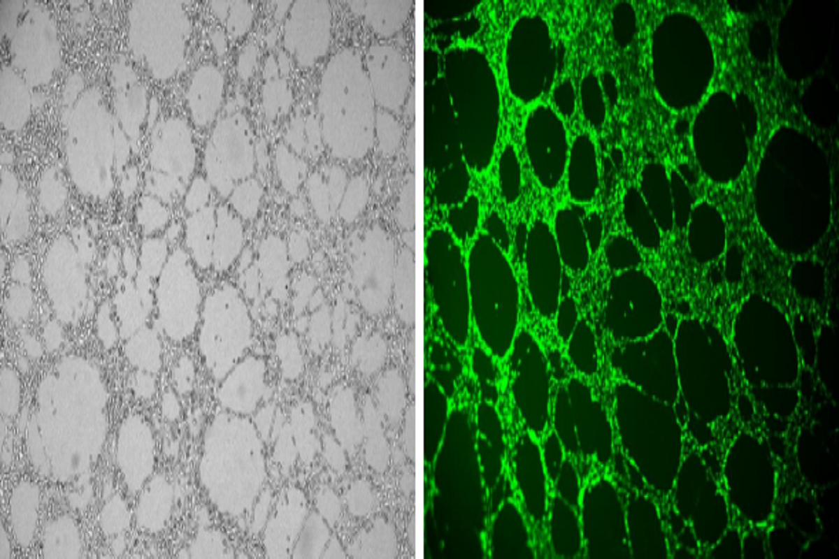 Versatile Applications of Matrix Gels: Angiogenesis Assay