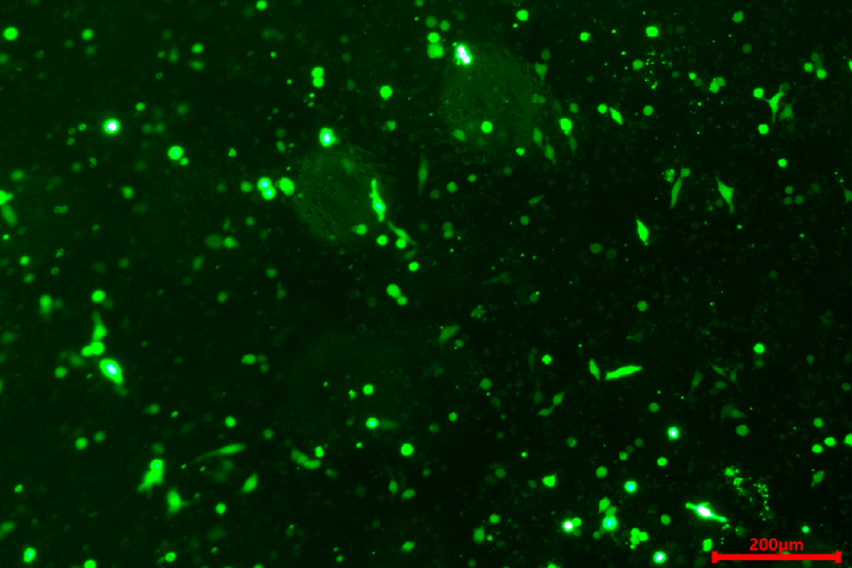 Cell Transfection | Transfection of DC2(Mouse Bone Marrow–Derived Dendritic Cells)-DNA