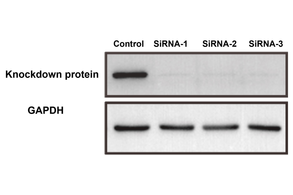 Cell Transfection | BMDM (Primary bone marrow-derived macrophages) Cells Transfection – siRNA