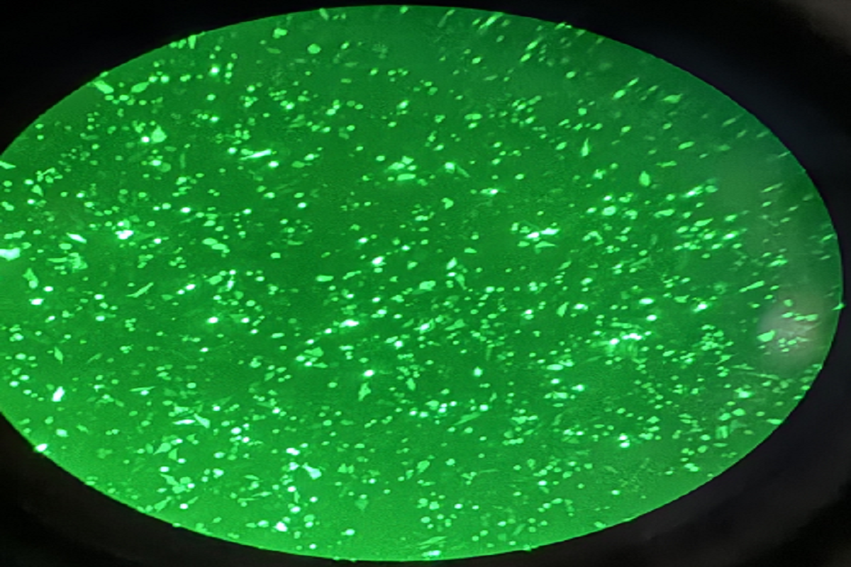 Cell Transfection | Transfection of MIA PaCa2(Human Pancreatic Cancer Cells)-DNA