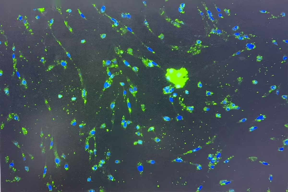 Cell Transfection | PC-12 Rat Adrenal Pheochromocytoma Cells Transfection– DNA