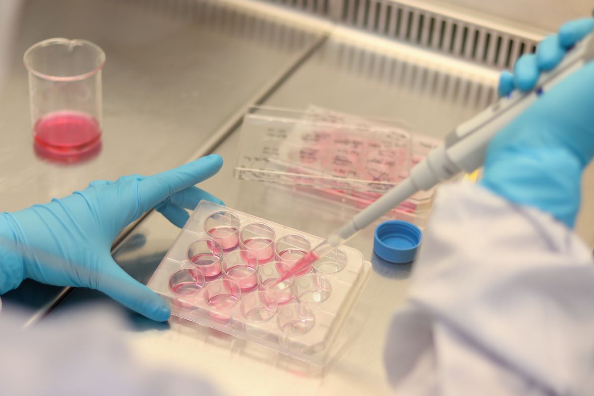 Application of Ceturegel™ Matrix Gel in Angiogenesis Experiments