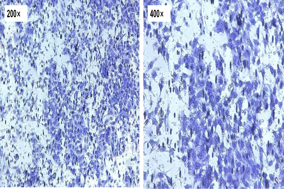 Versatile Applications of Matrix Gels: Cell Invasion Assay