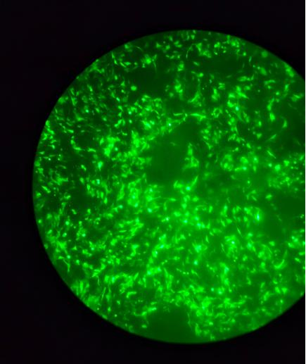Cell Transfection | Transfection of HT22 Mouse Hippocampal Neuronal Cells-DNA
