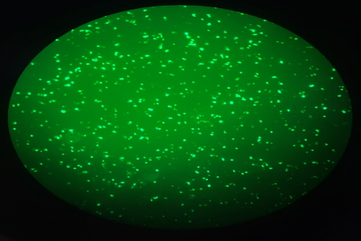 Cell Transfection | SNU719 (Human Gastric Carcinoma Cells ) Transfection – siRNA