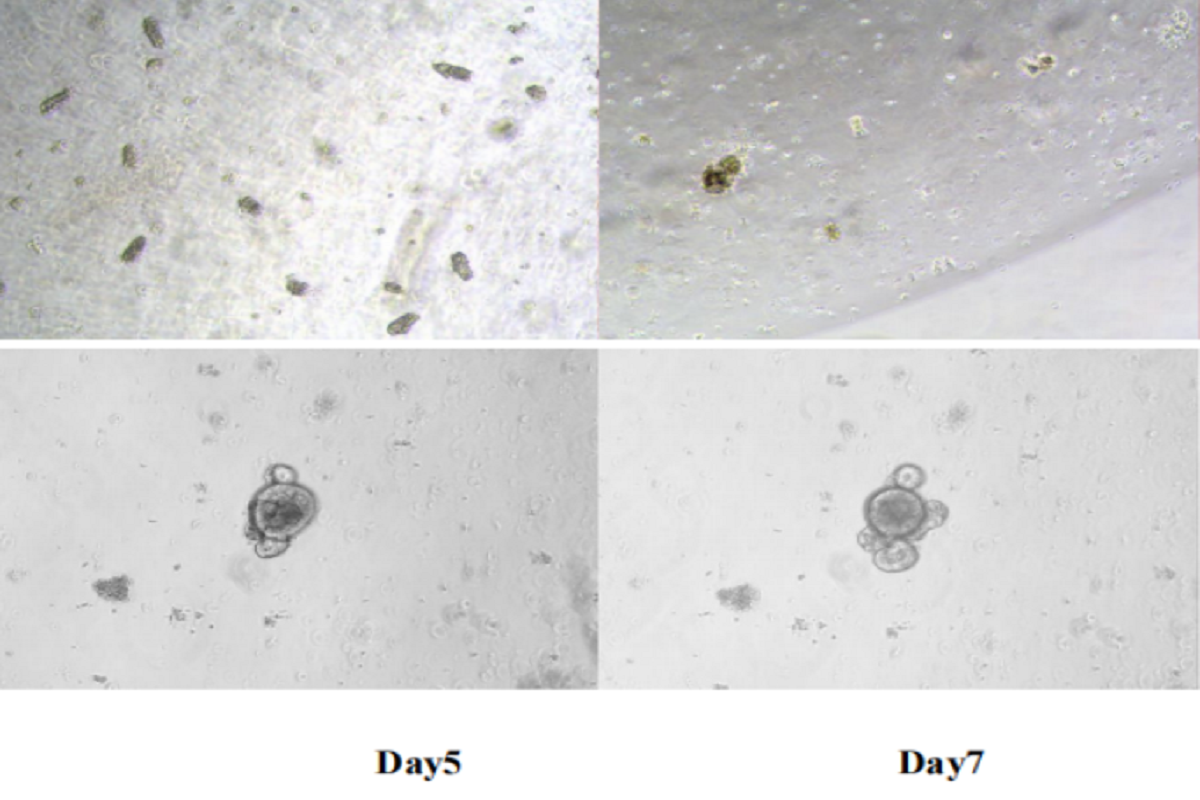 Versatile Applications of Matrix Gels: Organoid Culture