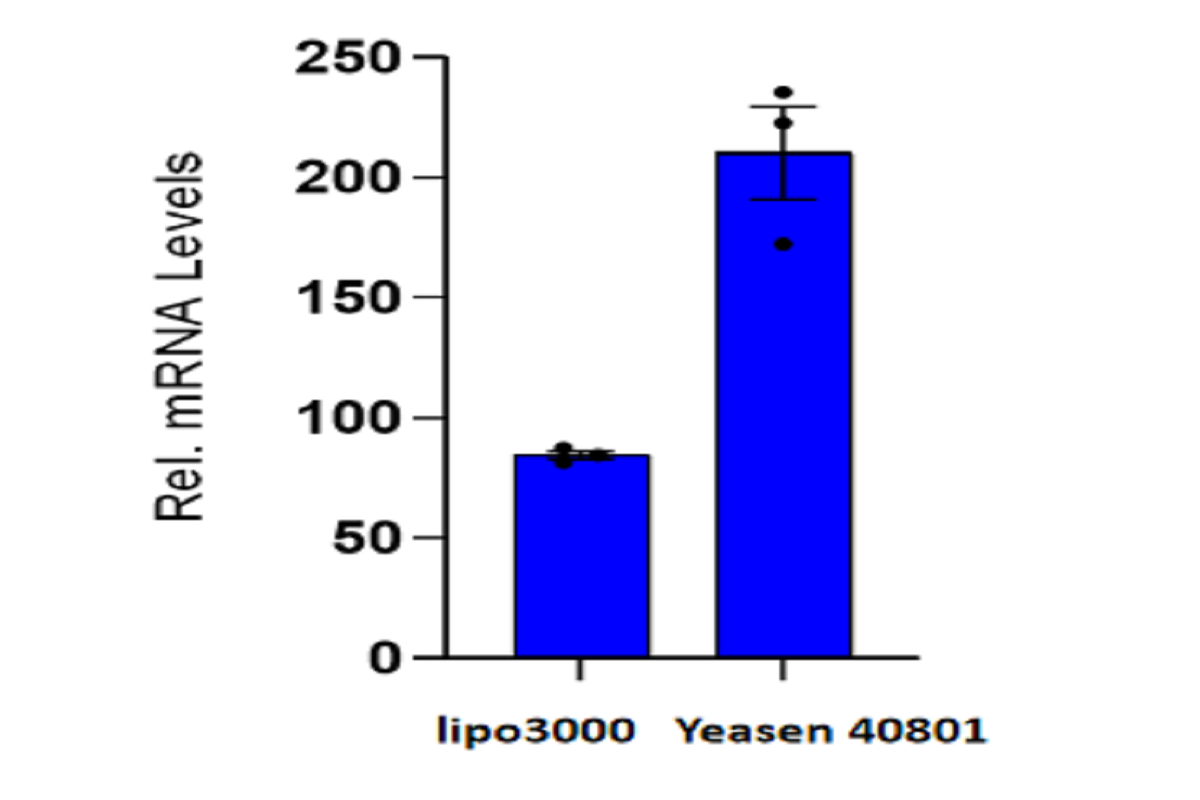 Cell Transfection | Transfection of THP-1 (Human Monocytic Leukemia Cells)-DNA