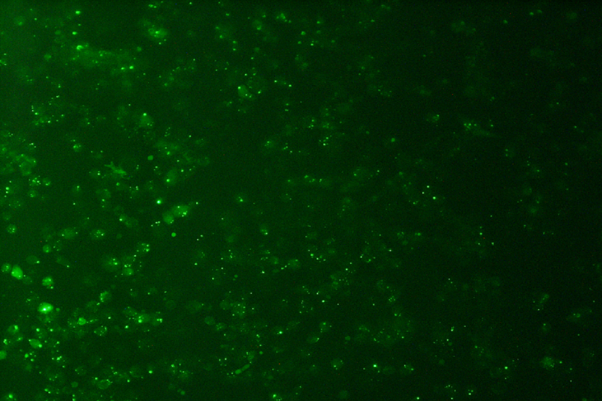 Cell Transfection | THP-1 (Human Monocytic Leukemia Cells) Transfection – siRNA