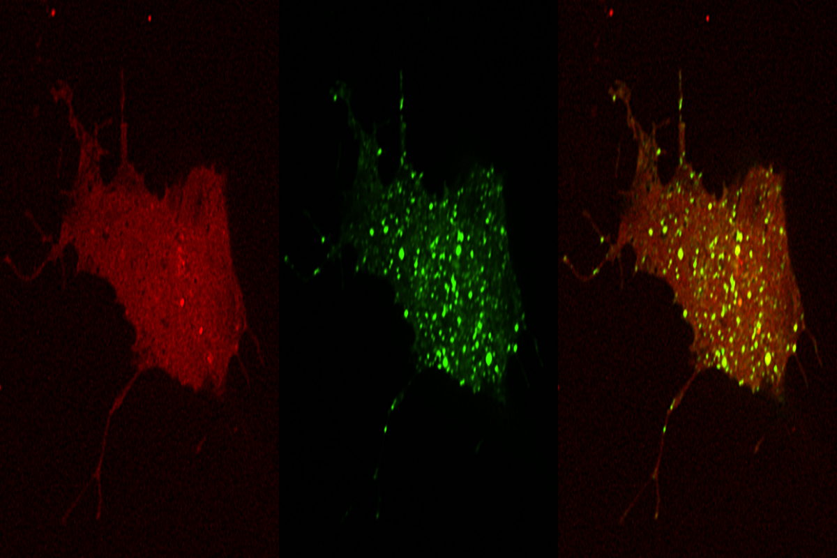 Cell Transfection | Transfection of NPC (Neural Progenitor Cells)-DNA