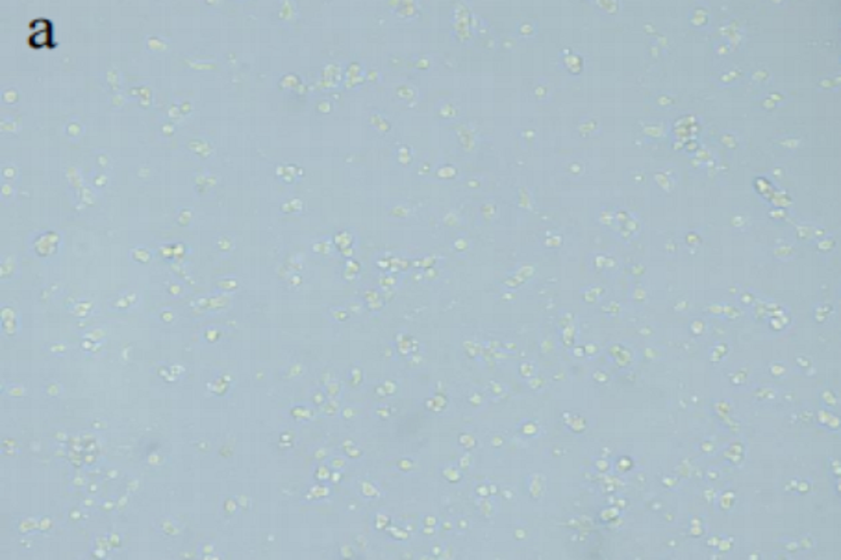 Versatile Applications of Matrix Gels: 2D Cell Culture