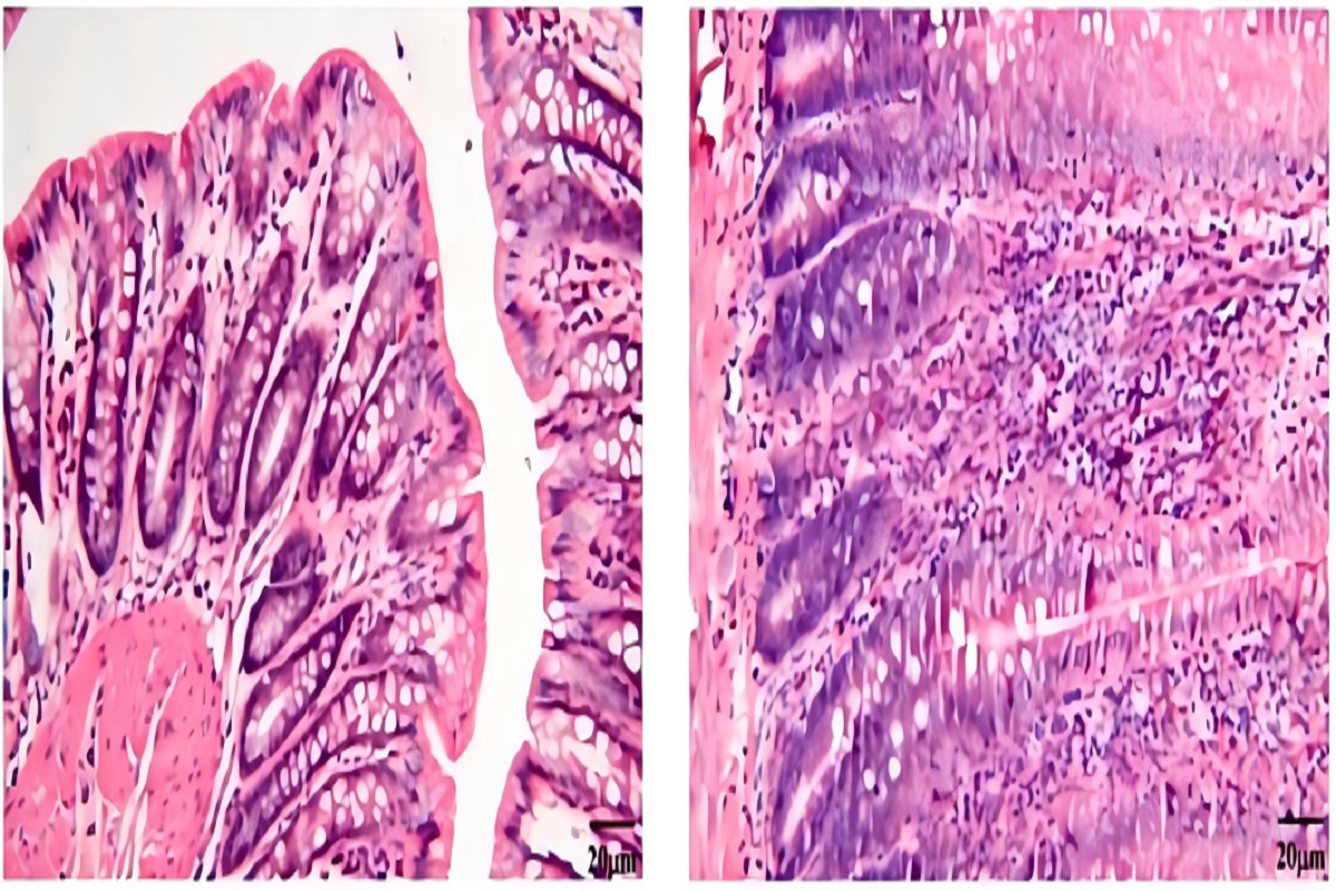 Ulcerative Colitis Rat Modeling using Dextran sodium sulfate (DSS)