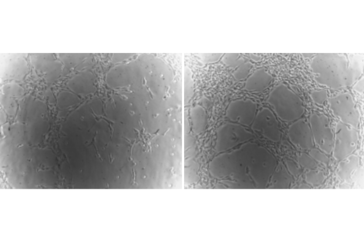 Angiogenesis Assay Case Study 3