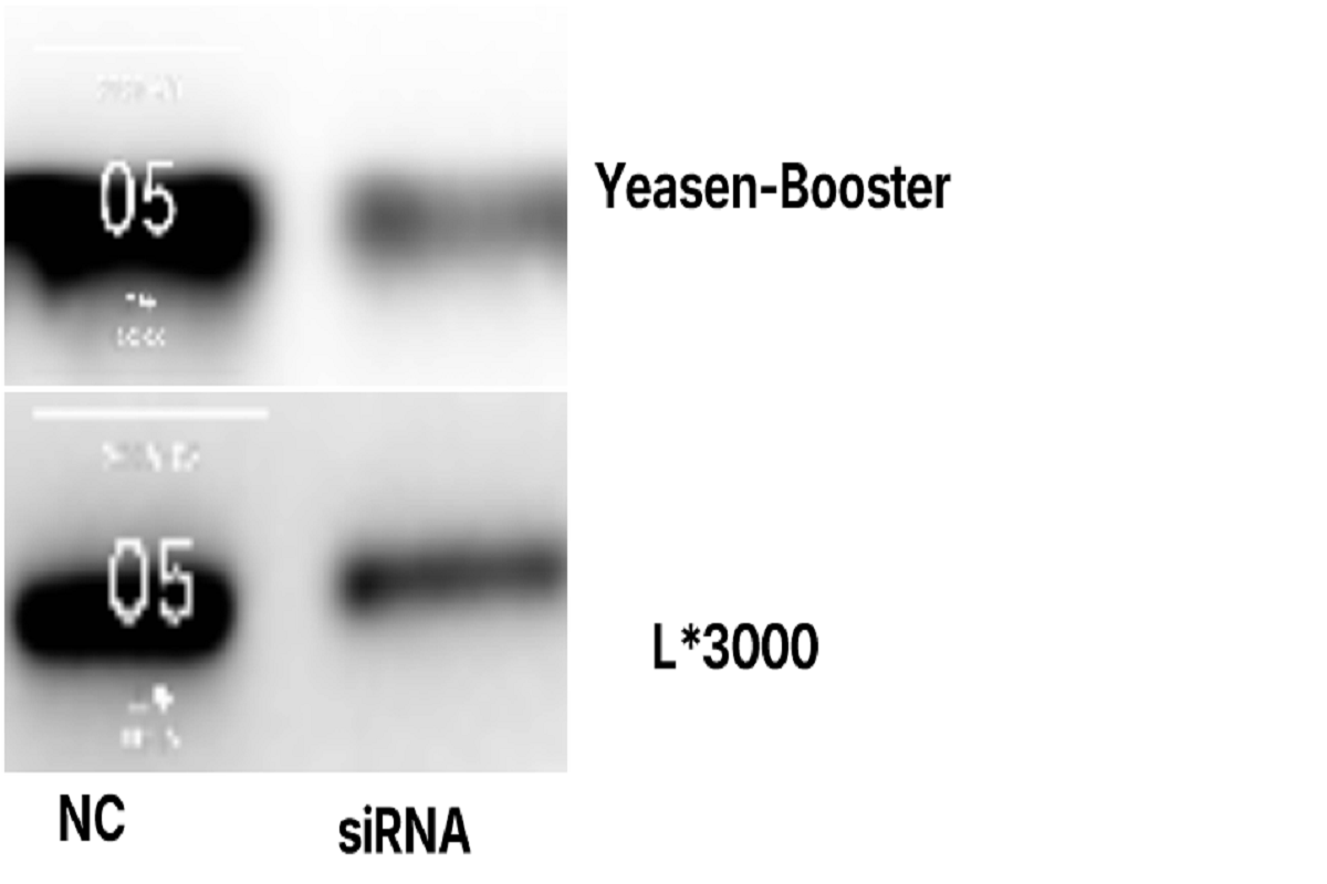 Cell Transfection | HGC-27 Human Gastric Cancer Cells Transfection – siRNA