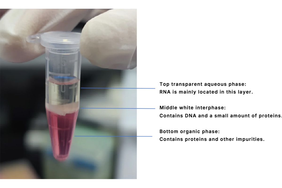 Common Issues and Troubleshooting in RNA Extraction Using TRIzol