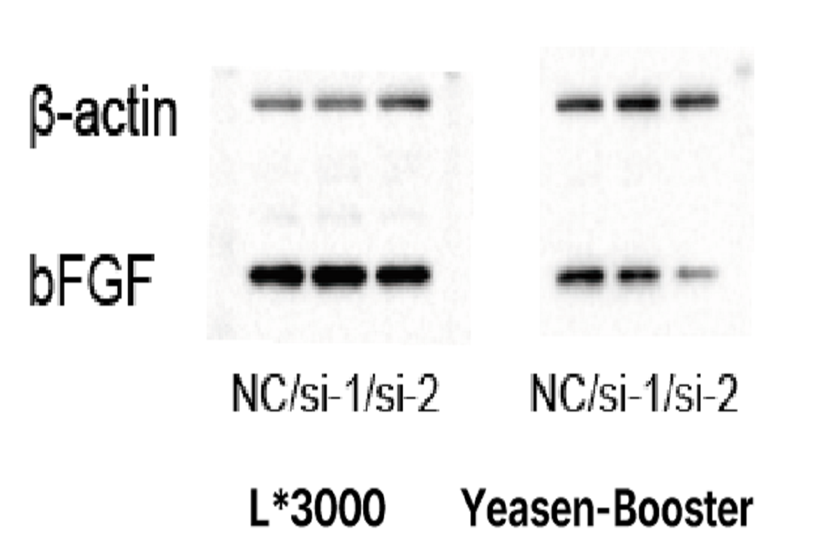 Cell Transfection | Transfection of Primary Bone Marrow-Derived Macrophages(BMDMs) – siRNA
