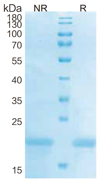 Human IL-28B-eiwit _ 90210es