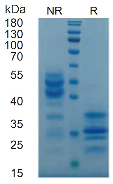 Mus IL-17A protein _ 90208ES