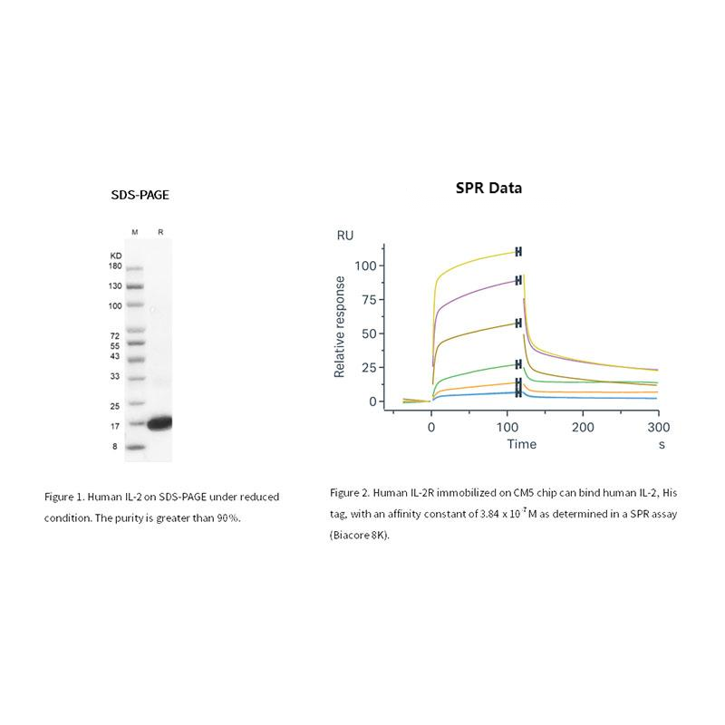 Proteína IL-2 humana recombinante, sua etiqueta _ 90103es